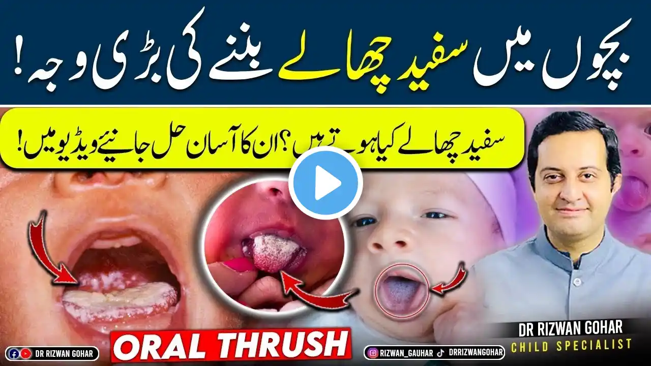 The secret to treating oral thrush 👅in babies #oral #thrush #treatment