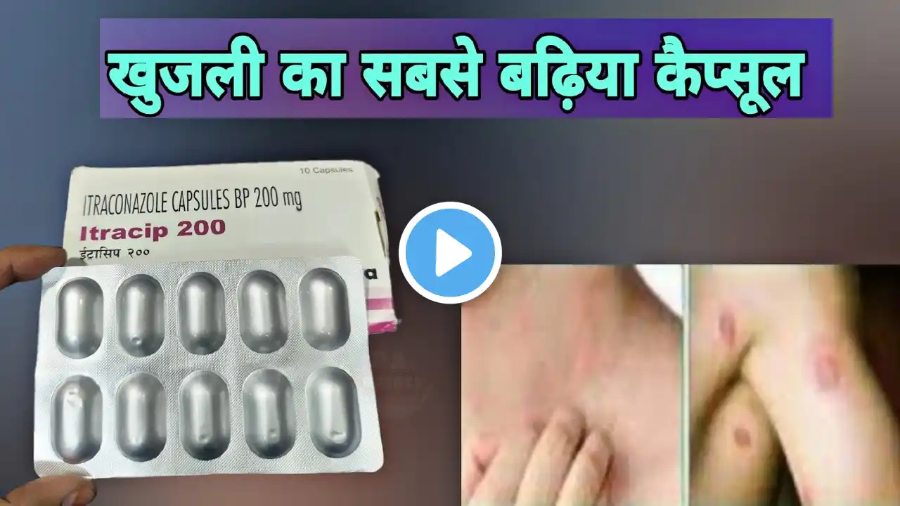 Itraconazole capsules 200 mg | fungal infection capsule | itracip 200 cipla | khujli ki dawai