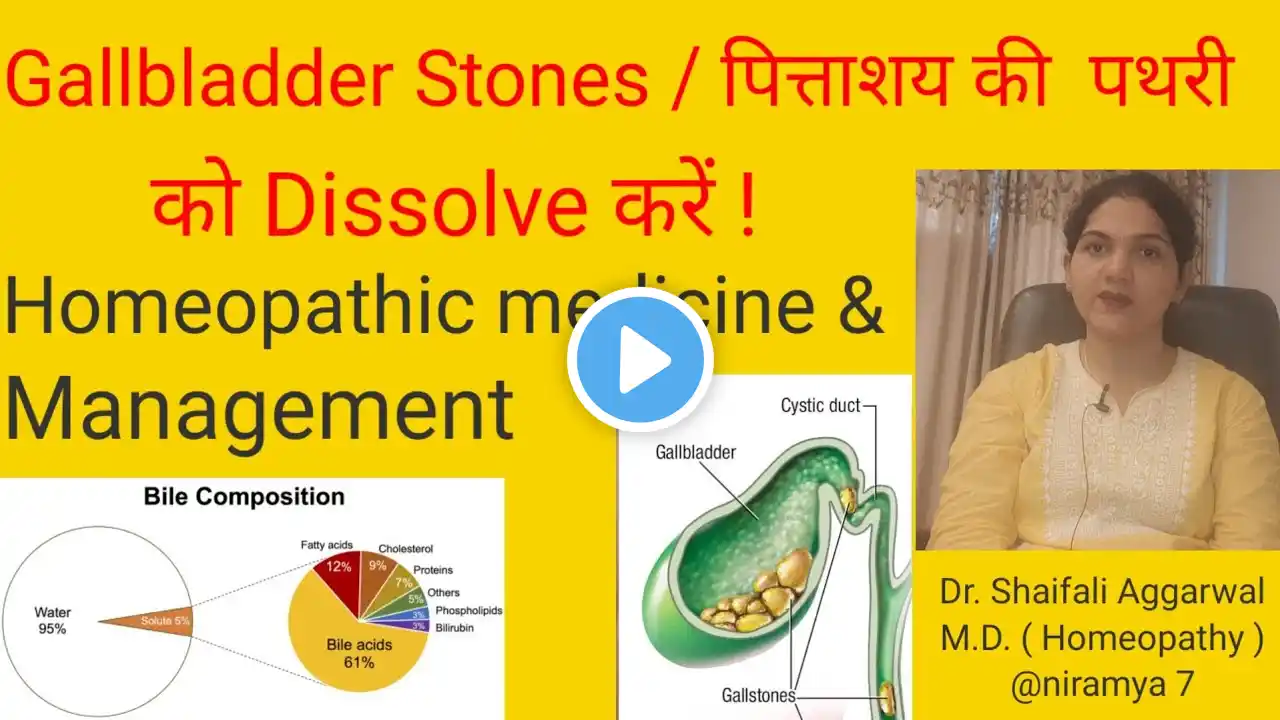 Gallbladder stones/ पित्त की थैली में पथरी/ Homeopathic Treatment & Management for Gallbladder stone