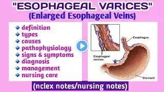 Esophageal Varices| Types| Causes| Pathophysiology| Symptoms| Diagnosis| Management| Nursing care