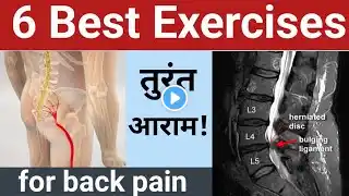 Best Exercise For Sciatica Pain, L4-L5-S1, Disc Bulge Treatment, Leg Pain Sciatica Treatment