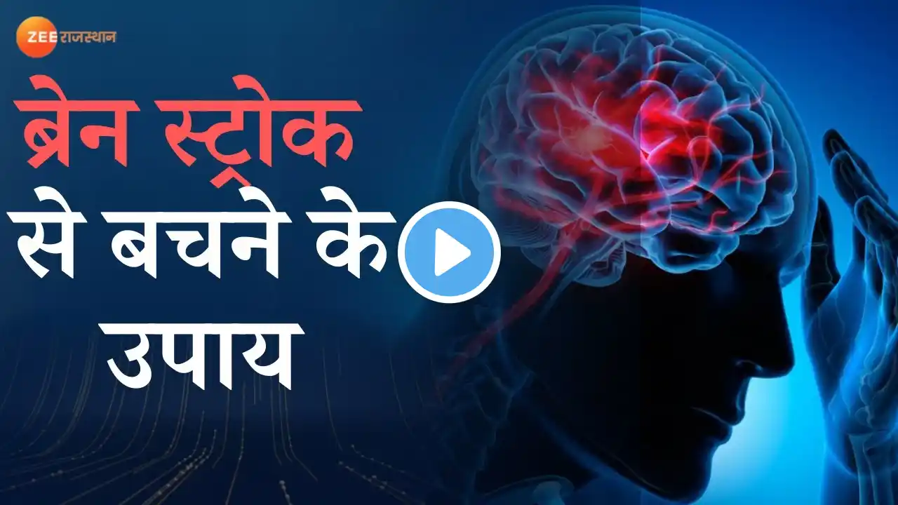 सर्दियों में क्यों बढ़ जाता है Brain Stroke का खतरा। जानें Expert की राय। Health News । Rajasthan