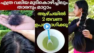 Hair fall & Dandruff treatment at home❤ Best hair pack for hair regrowth & Forehead hair loss remedy