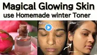 Glycerin Benefits for Skin and Side Effects : ग्लिसरिन के फायदे और नुकसान | Beautytipsyachika