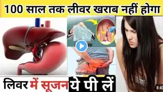 लिवर में सूजन | लिवर में सूजन के लक्षण | fatty liver treatment | fatty liver symptoms