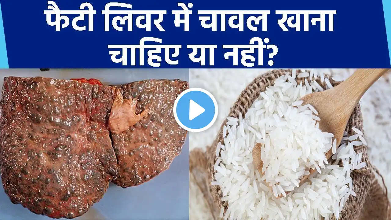 फैटी लिवर में चावल खाना सही या गलत? Fatty liver me chawal khana chahiye ya nahi।Boldsky*Health