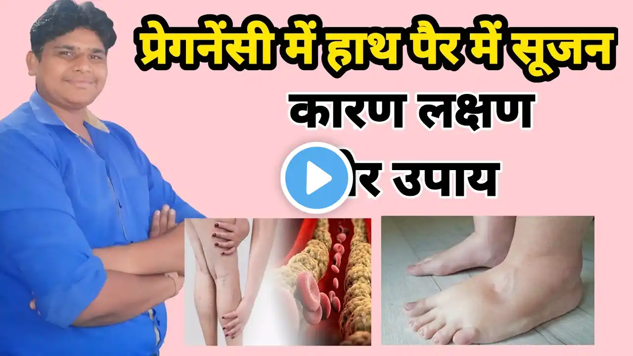 Pregnancy Mai Pairo Mai Sujan | प्रेगनेंसी में हाथों पैरों में सूजन के कारण| Swelling in legs during