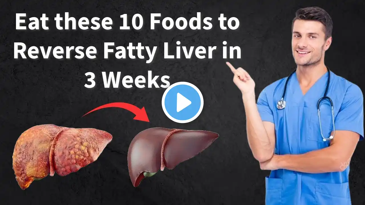 Eat these 10 Foods to Reverse Fatty Liver in 3 Weeks | Fatty Liver Treatment