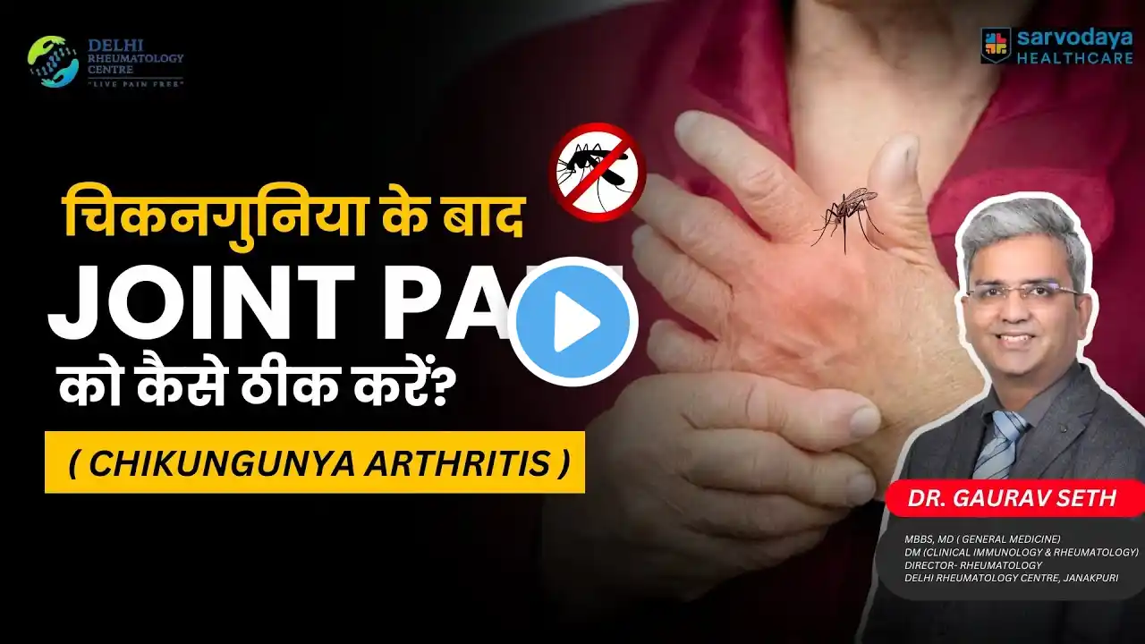 चिकनगुनिया के बाद Joint Pain को कैसे ठीक करें? | Chikungunya Arthritis in Hindi | Dr. Gaurav Seth