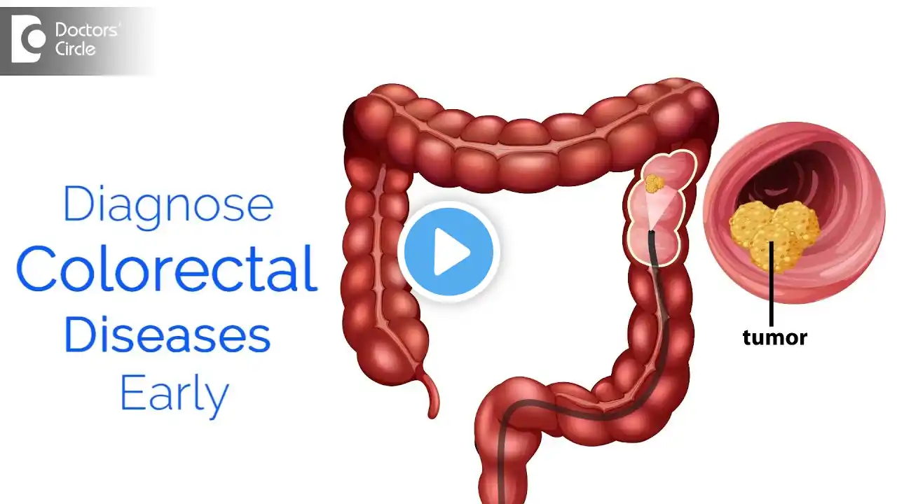 Early Detection of COLORECTAL DISEASES | Know the Importance - Dr. Nanda Rajaneesh | Doctors' Circle