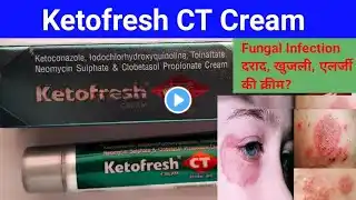 Ketofresh CT Cream || Fungal infection Ki Best Medicine Uses In Hindi ||