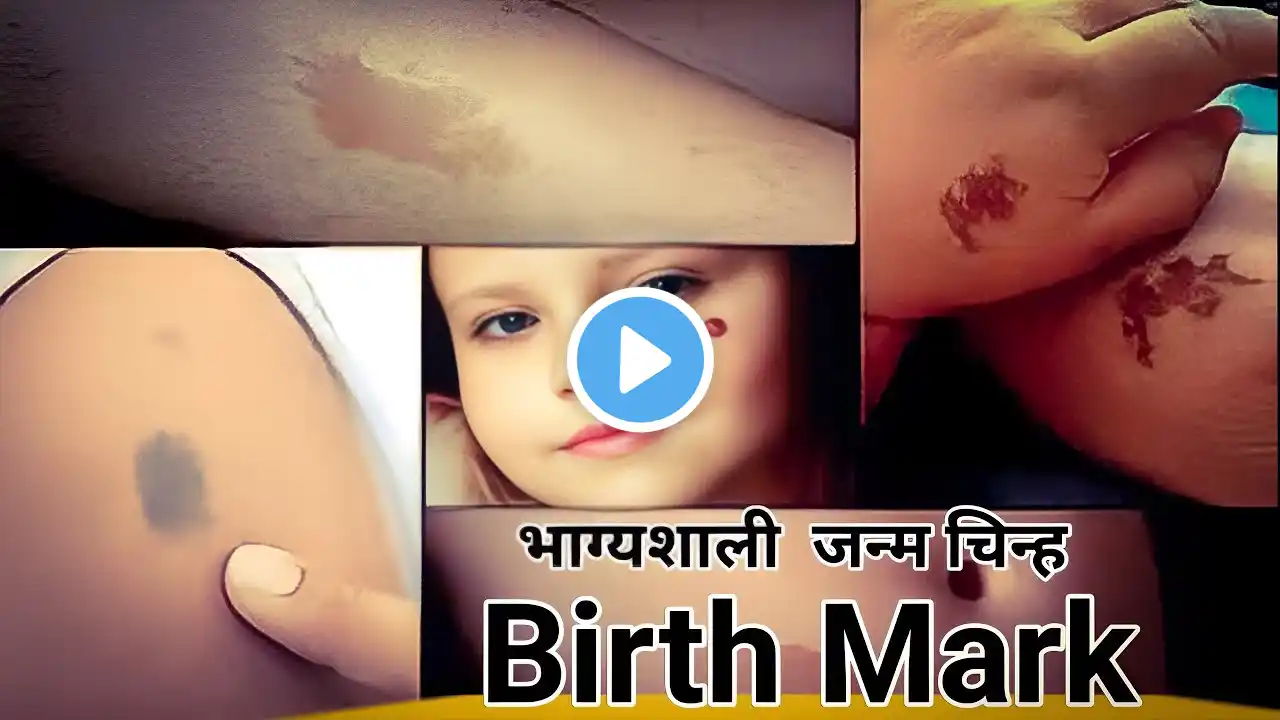 Birth Mark Astrology | Janm Chinh | Birth Mark Indicates | Birth Mark On Body | Birth Mark Facts