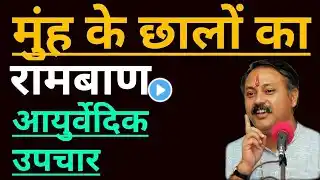 मुंह और जीभ के छालों का घरेलू रामबाण उपचार | Ayurvedic Home Remedy For Mouth & Tongue Ulcers Rajivji