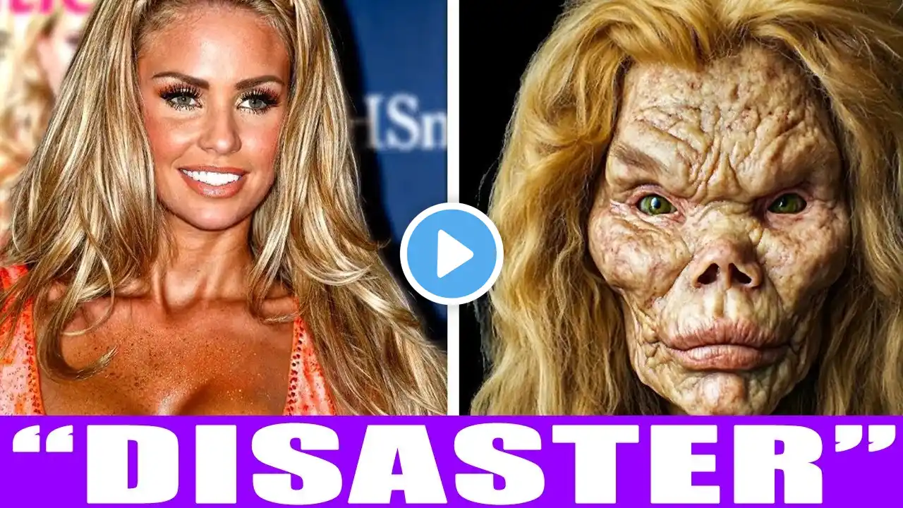 15 lgbt celebrities with failed plastic surgery 2025 | then and now 2025 gay