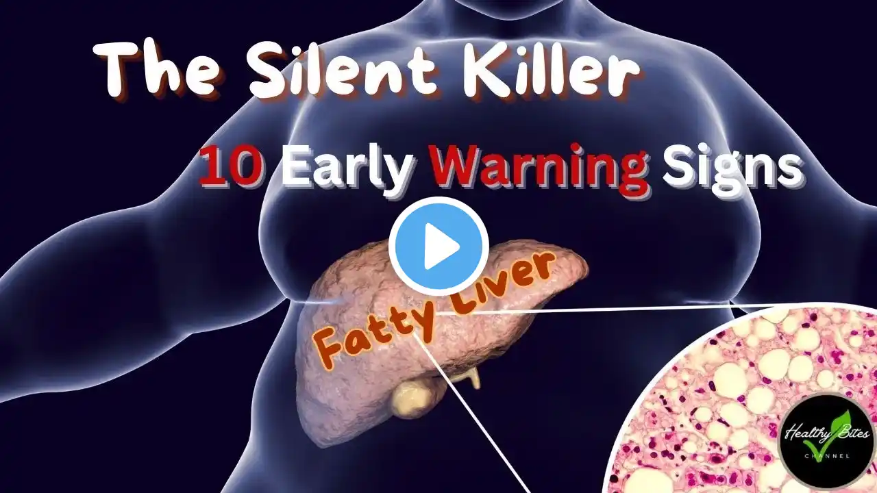 10 Alarming Signs of Fatty Liver & 5 Natural Ways to Reverse It
