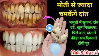 सिर्फ 2 मिनट में पीले गंदे दांतों को मोती की तरह चमका देगा यह घरेलू नुस्खा / Teeth whitening remedy