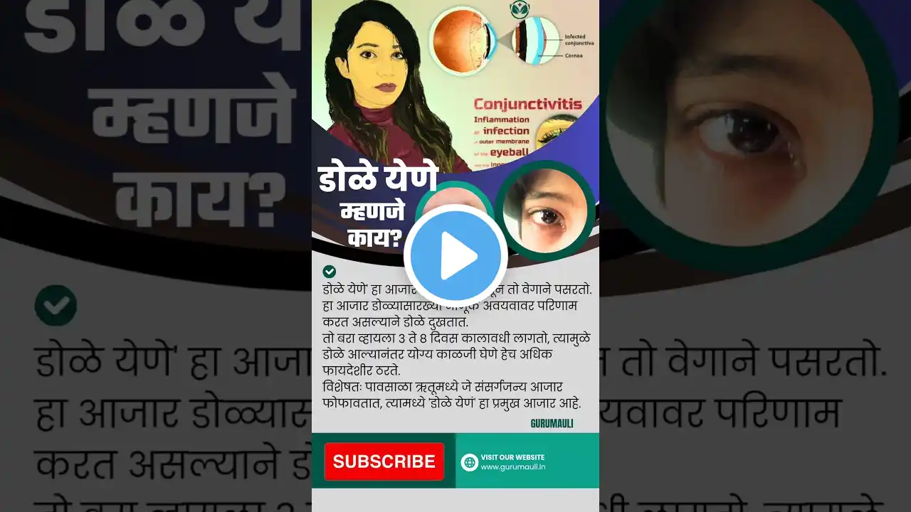 🧐 डोळे येणे म्हणजे काय? conjunctivitis | #shorts  #viral