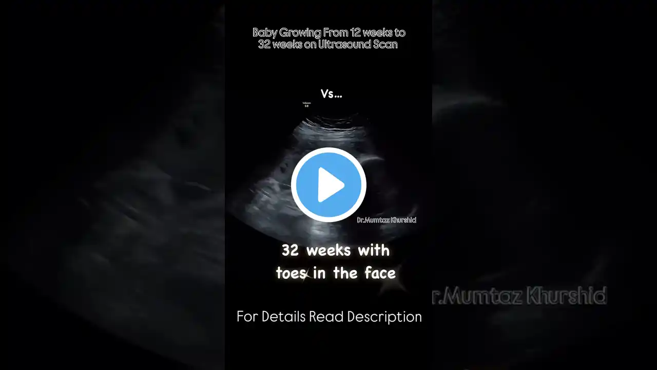 Baby Growth from 12 Weeks to 32 Weeks seen On Ultrasound Scan