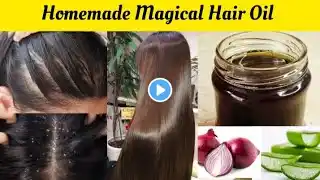 Homemade Magical Hair Oil | Aloe Vera and Onion Hair Oil Remedy #hairfall #hairgrowth #dandruff