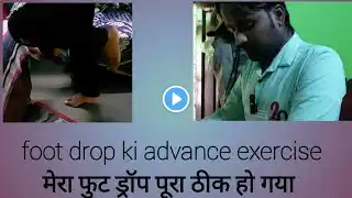 foot drop advance exercise मेरा फुट ड्रॉप पूरा ठीक हो गया