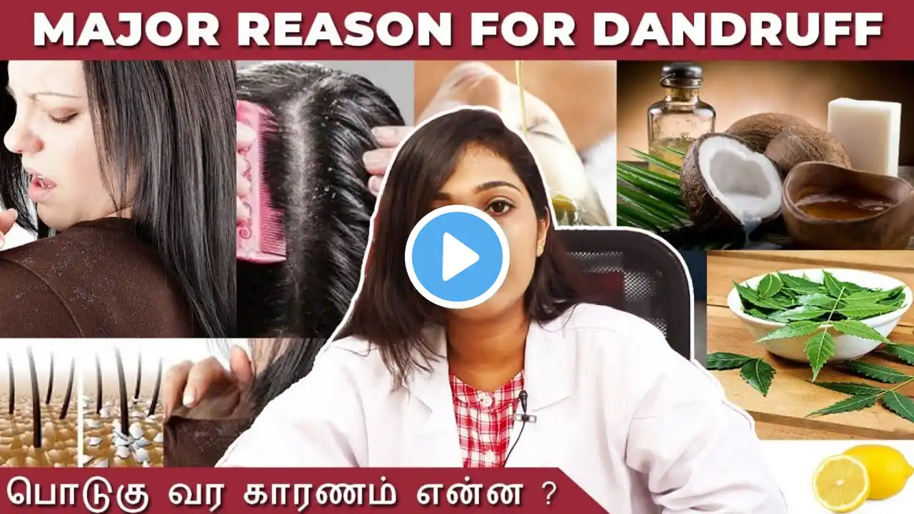 Major Reason for Dandruff |  Dandruff Tips & Treatment | Elixify |  Tamil