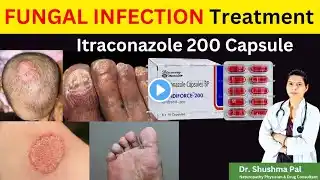 Candiforce 200 Capsule || Itraconazole 200 capsule || Fungal Infection Treatment