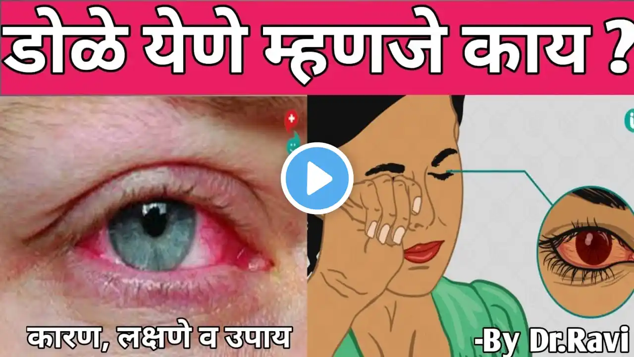 डोळे येणे म्हणजे काय ? कारणे, लक्षणे व उपाय | What is conjunctivitis ? Causes, signs & Symptms ?