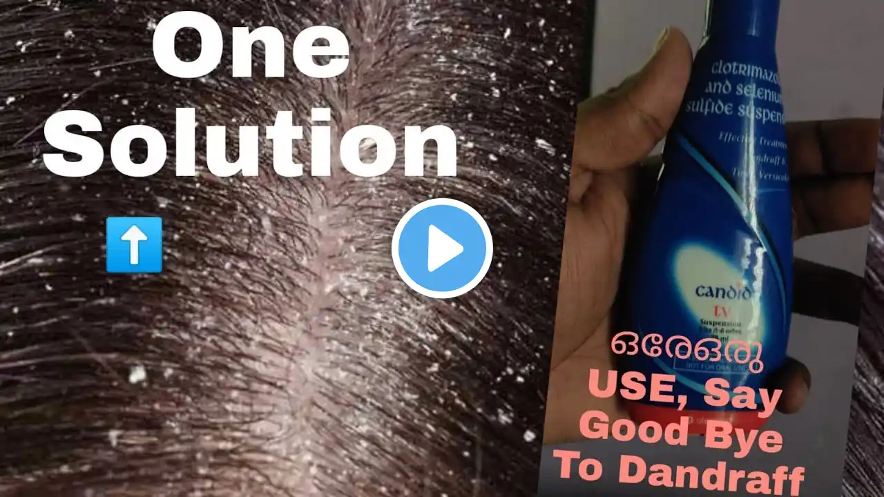 Dandruff Removing Shampo in one use / candid tv/