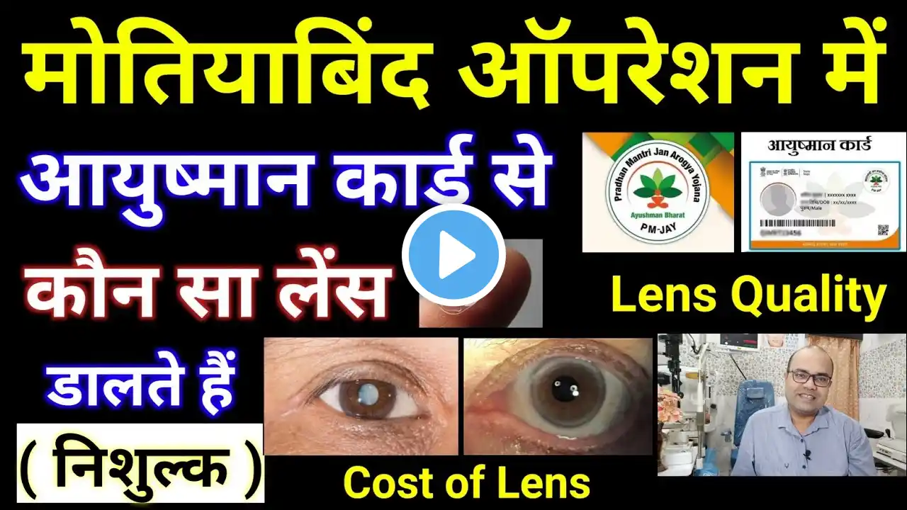 आयुष्मान कार्ड से मोतियाबिंद ऑपरेशन में कौन सा लेंस डालते हैं निशुल्क | Lens Quality | Cost Of Lens