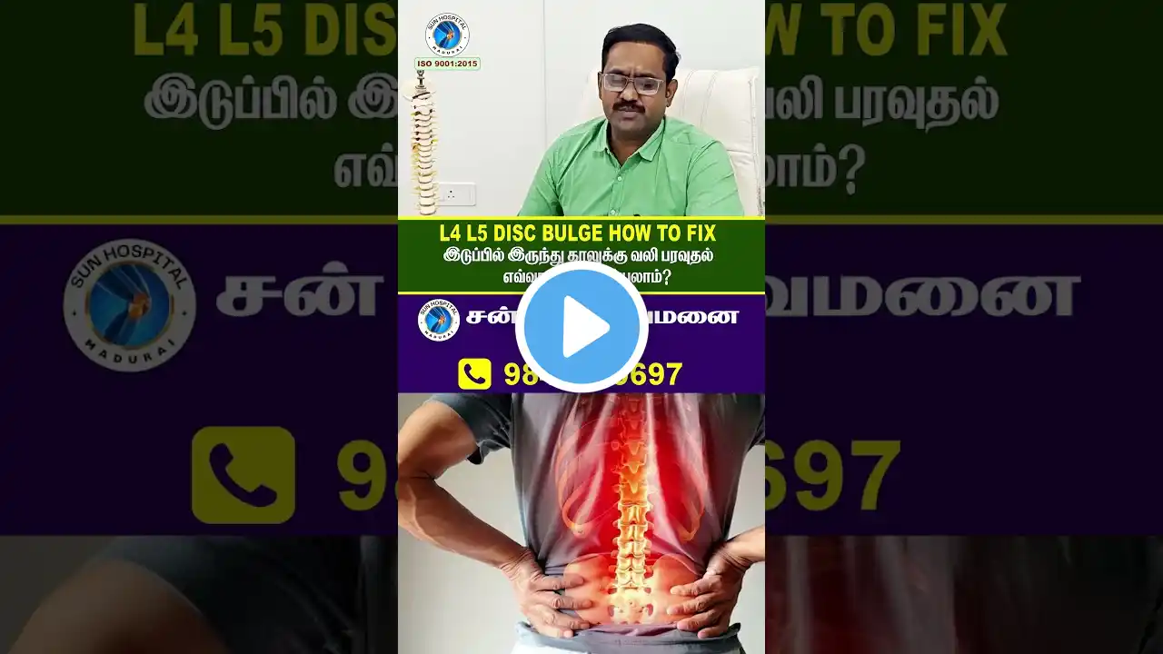 சியாட்டிகா நரம்பு வலி உடனடி தீர்வு | Sciatica Severe Backpain | Sun Hospital Madurai