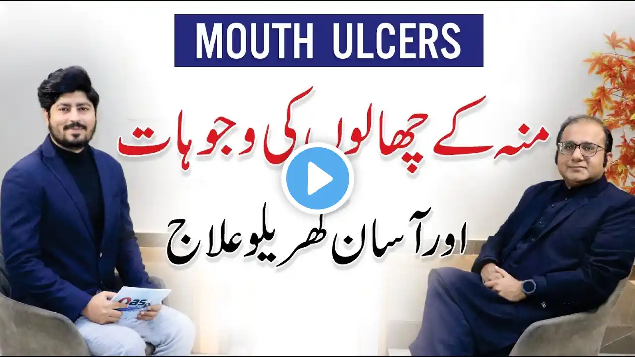 Mouth Ulcer Causes & Treatment | Muh K Chalon Ka Ilaj | Dr. Imran Zia | Dentist