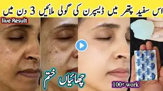 Parmenat Sun Tan Removal within 5 Minute |SunbTan Removal Home Remedy | Pigmentation removal at Home