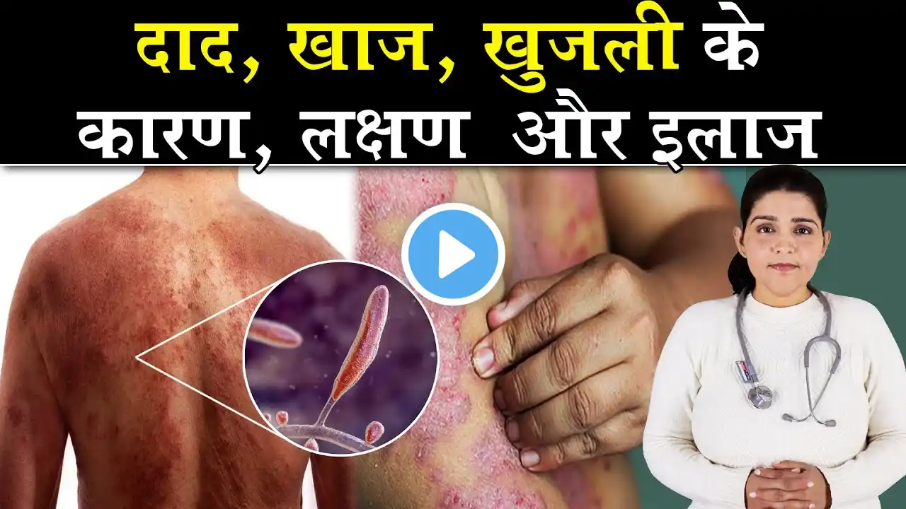 दाद, खाज, खुजली के कारण, लक्षण और इलाज  | Ringworm : Causes and Treatment | Dr Deepika Rana