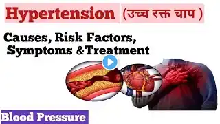 Hypertension (उच्च रक्त दाब )//causes, Risk Factor, Treatment //