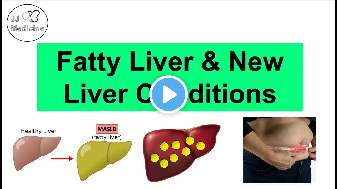 Fatty Liver (NAFLD) & “New” Liver Conditions | MASLD, MetALD & Others (Diagnostic Criteria)