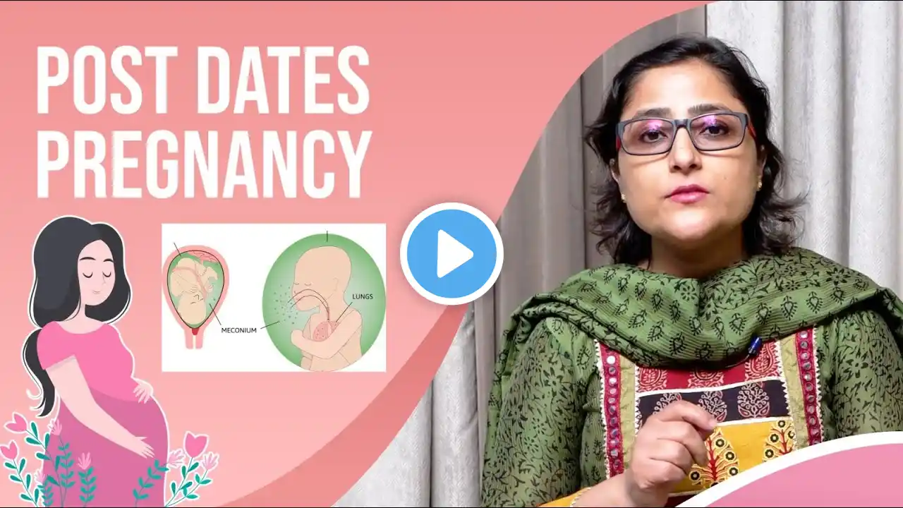 Post dates pregnancy , डिलीवरी की डेट निकल गई है अब क्या करें