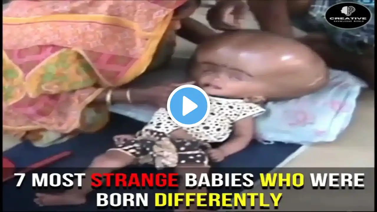 7 Most Strange Babies Who Were Born Differently