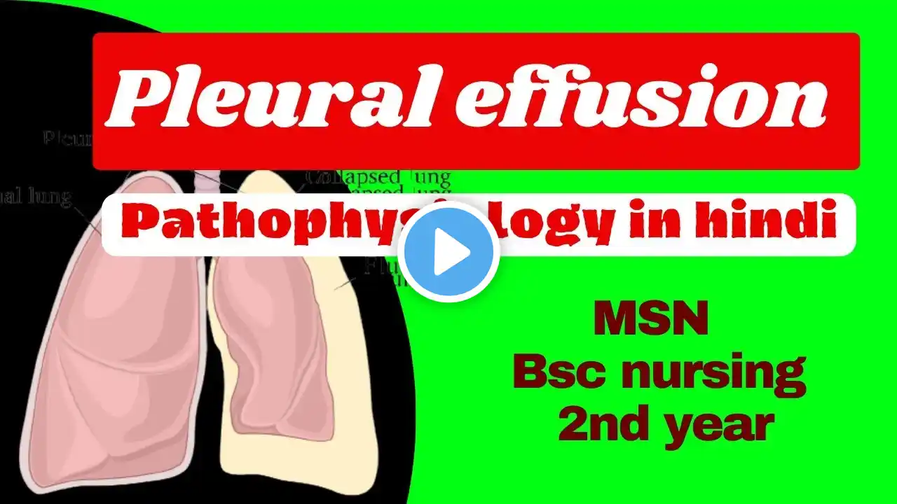 Pleural effusion msn bsc nursing 2nd year | pleural effusion pathophysiology | Nursing lecture