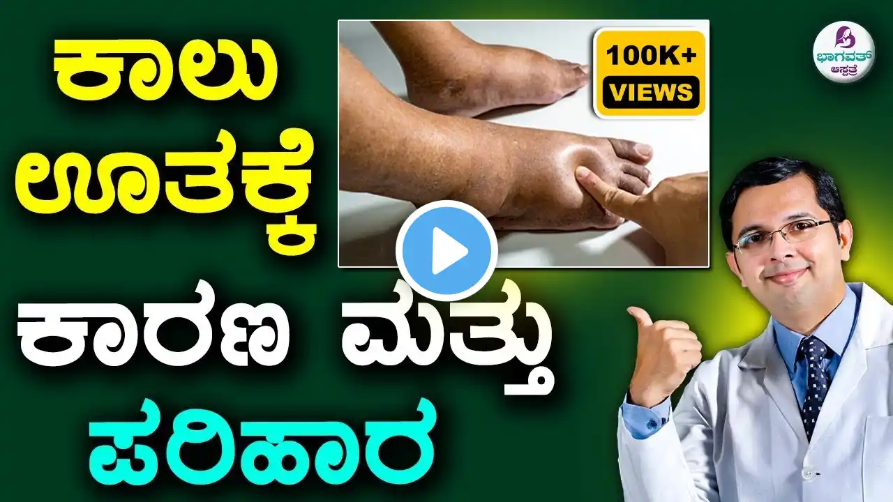 V116 - Leg , Ankle & Foot Swelling Causes and Home remedies | ಕಾಲು ಊತಕ್ಕೆ ಕಾರಣ & ಪರಿಹಾರ ಉದಾಸೀನ  ಬೇಡ