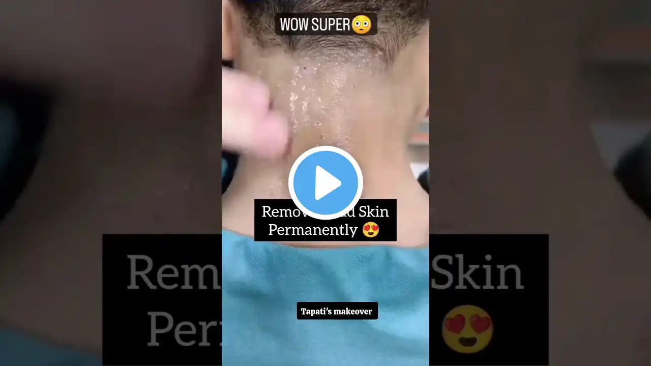 š„Clean Dark Neck Instantly At Home/Remove Dark Neck Fast #shorts #skincare #youtubeshorts