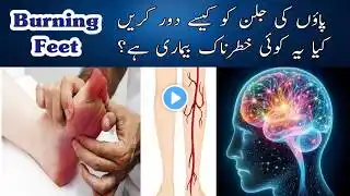 Pairo Me Jalan Ka Ilaj | Burning Feet Home Remedy | पैरों की जलन का घरेलू इलाज |Homeopathic Medicine