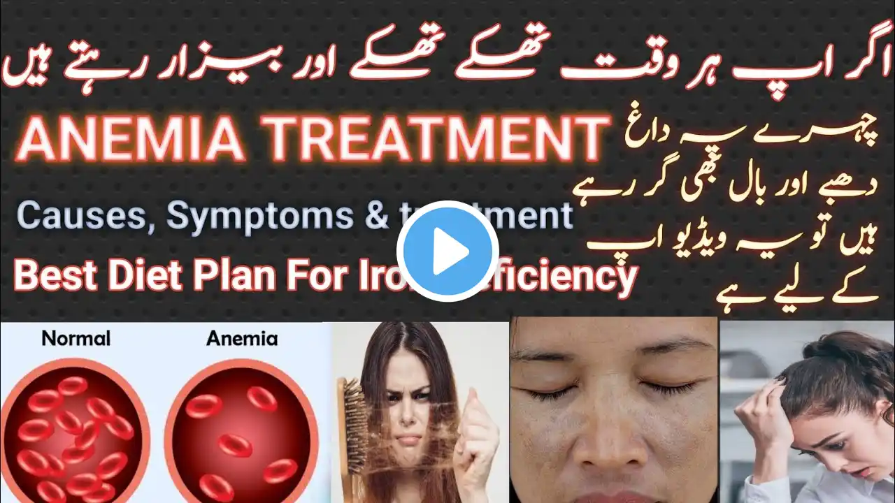 Iron Deficiancy Anemia Symptoms  & Treatment | Diet plan for Iron deficiency | khoon ki kmi ka ilaj