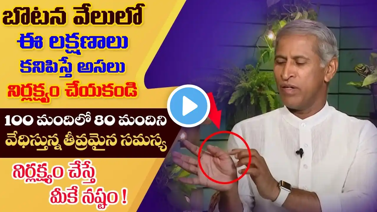 How to Control Uric Acid?| Food Habits to Prevent Uric Acid | Urine Infection |Manthena's Health Tip