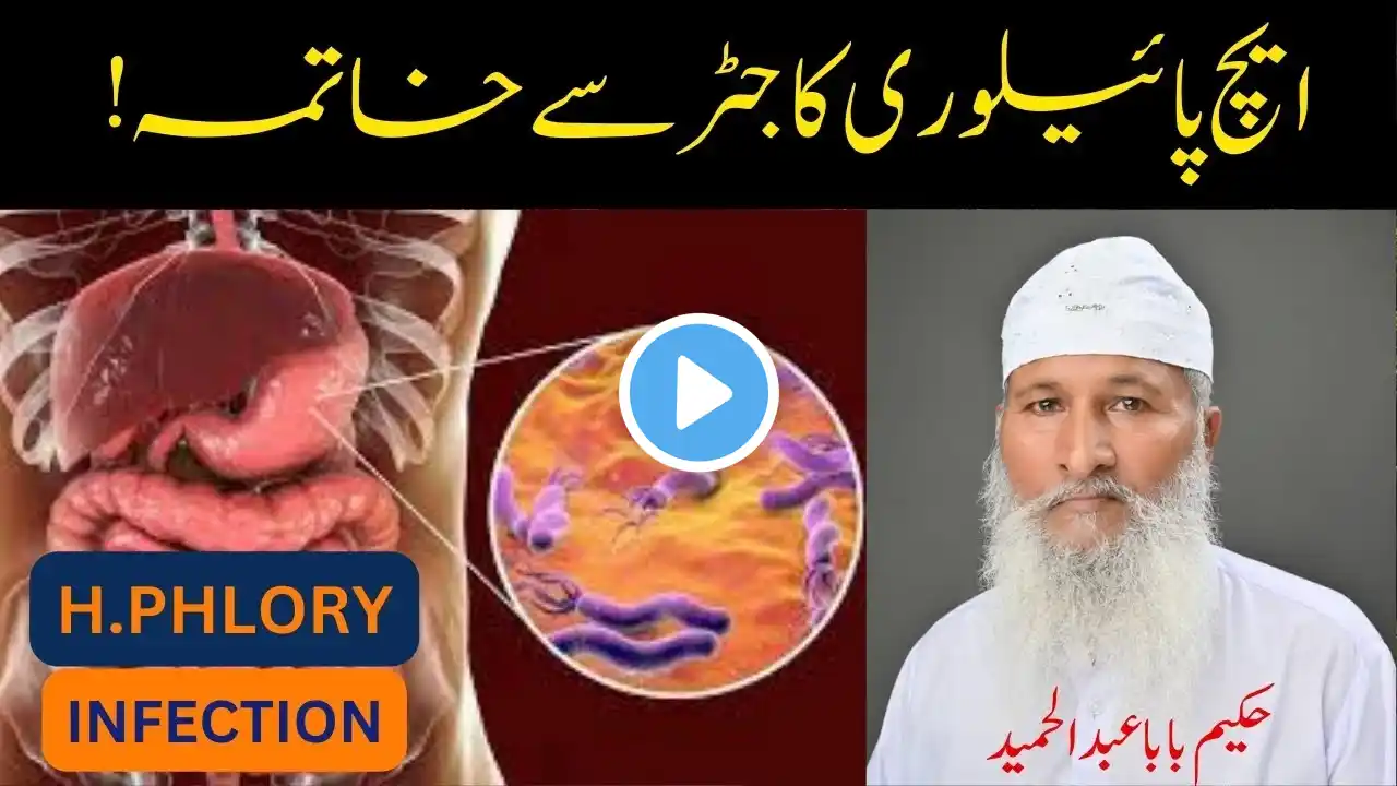 H Pylori Infection Treatment Urdu/Hindi - Stomach Ulcer Treatment - Helicobacter Pylori Symptom