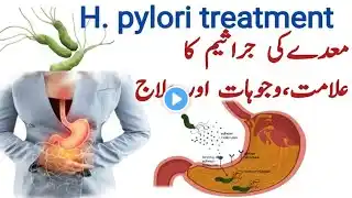 H pylori infection treatment | Helicobacter pylori | H pylori treatment in urdu | Stomach ulcer