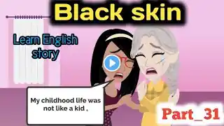 Black skin part 31 | Animated story | English story | learn English | Simple English