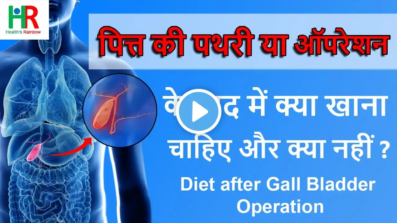 पित् की थैली की सर्जरी के बाद क्या खाना चाहिए है & क्या नहीं | what to eat after gallbladder surgery