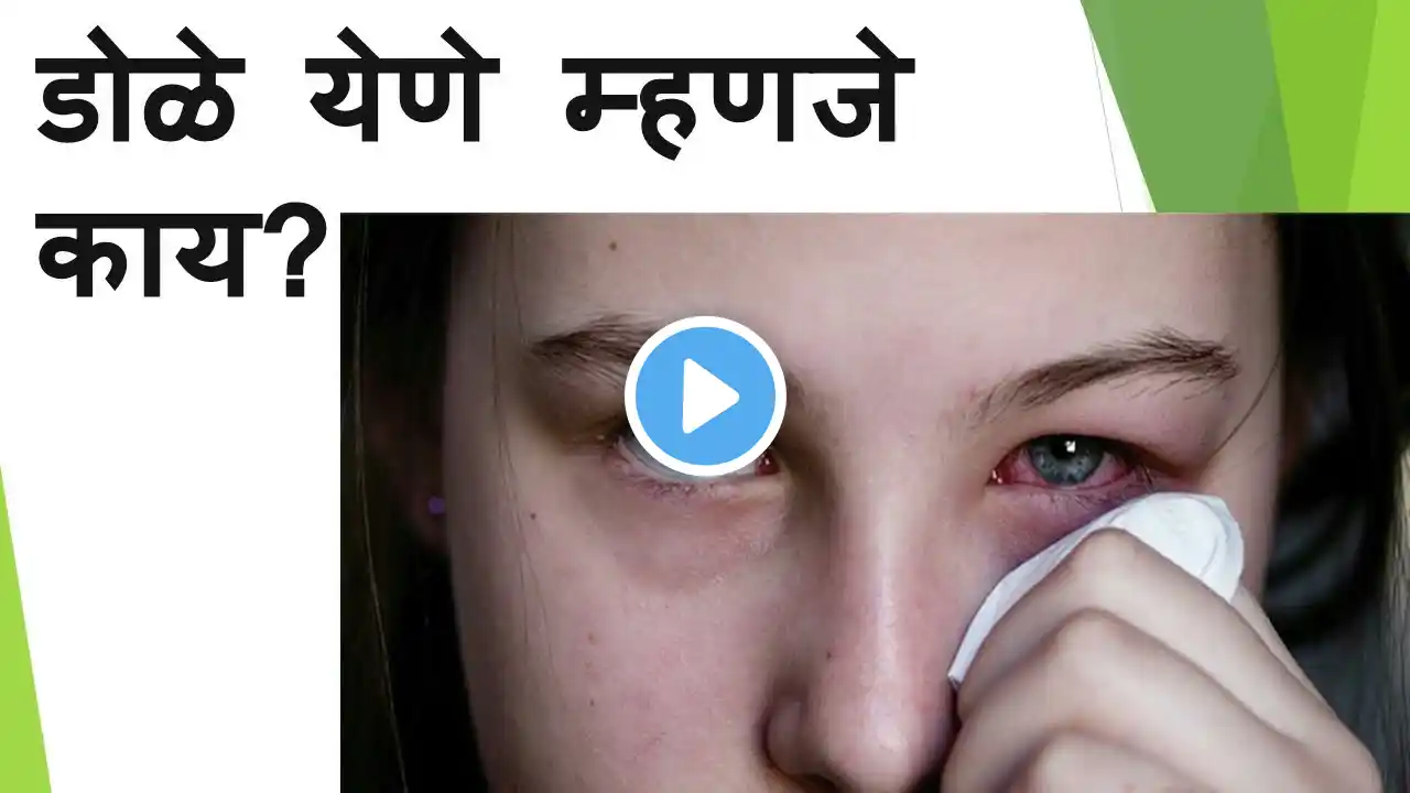 डोळे येणे म्हणजे काय? लक्षणं काय?conjunctivitis/eye diseases/eye problem/conjunctivitis treatment